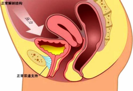 漏尿之“笑尿”篇——我笑尿了*不，你是真尿啦！